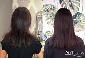 Medications are available that can help restore women's hair, too. Post Pregnancy Hair Loss Nutress