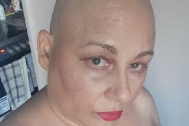 Fundraiser for Chimene Puder by Lynne Burnet : It takes a village