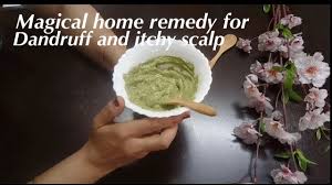 Magical Home Remedy For Dandruff Itchy Scalp Treatment For Dandruff Itchy Scalp Youtube