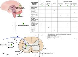 Image result for Neurologic Lesion Localization