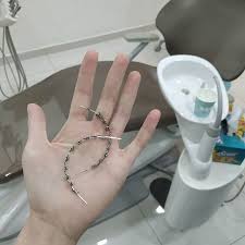 Lingual braces tend to cost more than traditional braces. Suraya Ringgitohringgit Com On Twitter Rm8500 And 1 5 Years Later The Treatment Is Done I M No Longer A Braceface Google Ringgitohringgit Braces Cost In Malaysia If You Want To Find Out