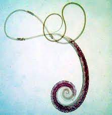 We did not find results for: Whipworm Nematode Britannica