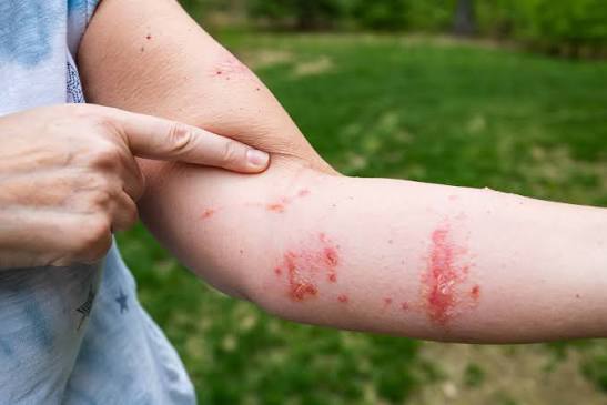 Tìm hiểu tất cả về cây thường xuân độc