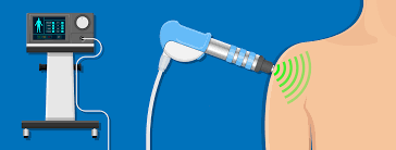 » deux à trois séances (70 à 100 € l'une) suffisent généralement, elles seront en partie remboursées en cas de prescription médicale (voir avec votre mutuelle pour une prise en charge complémentaire) Le Traitement Par Ondes De Choc Chez Les Kines Le Blog De La Reeducation Et De La Masso Kinesitherapie