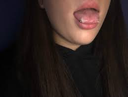 Der käuferschutz ist deine absicherung, wenn eine ware nicht ankommt, beschädigt ist oder nicht der beschreibung entspricht. Zungenpiercing Entzundet Achtung Bild Piercing