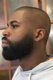 This sucks and is a real confidence killer. Black Man Hair Thinning Novocom Top