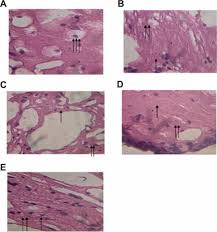 Image result for Multidentia crassa