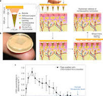 Slowly dissolving intradermal microneedles | Nature ...