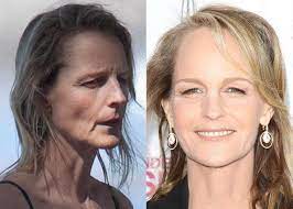 A year later she made her professional debut and afterwards worked steadily in films, theatre and television. Helen Hunt Before And After Plastic Surgery Celebrity Plastic Surgery Celebs Without Makeup Celebs