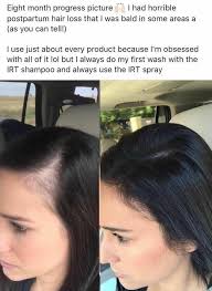 Top mamas, restore your hair and nails after childbirth  https://youtu.be/devE70qCFlI