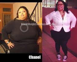 Pin On Before And After Weight Loss Stories