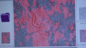 Everything we know so far. California S 1st Cases Of South African Covid 19 Variant Confirmed In Alameda Santa Clara Counties Officials Say Abc7 San Francisco