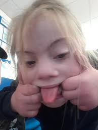 Kasey-Leigh's journey with down syndrome