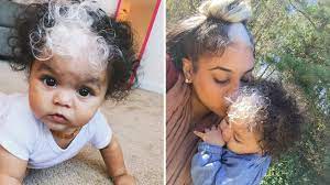 Little Girl Born With A White Patch Of Hair Which Is Exactly The Same As Her Mum S White Streak In Hair Streak In Hair Mom Hairstyles