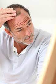 brittle bone medication can help your baldness hair loss the doctors tv show hair shampoo best