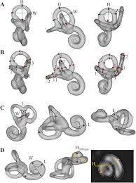 Ie Map A Novel In Vivo Atlas Template Of The Human Inner Ear Medrxiv