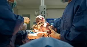 Newborn baby cared for by gloved hands immediately after birth