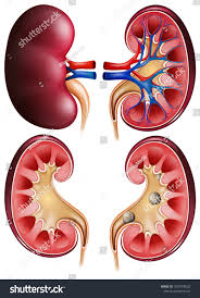 Kidneys And Kidney Stones On Poster Illustration Ad Affiliate Kidney Kidneys Stones Illustration In 2020 Illustration Poster Writing Templates