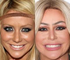 Creating faces from lips after skin surgery experience