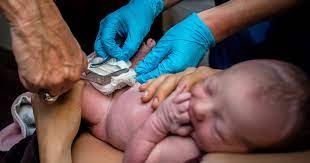 Why Delayed Cord Clamping Is A Must Plus How To Ask For It