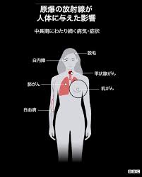理矢理マンコにチンコ入れたい 胸とマンコ舐めたい 全員可愛い 全員と中だしセックスしたい 一緒に入りたい 服. å¿«æ™´ã®æœãŒãŸã¡ã¾ã¡åœ°ç„ã« ãƒªãƒˆãƒ«ãƒœãƒ¼ã‚¤ã¨ãƒ•ã‚¡ãƒƒãƒˆãƒžãƒ³ã®æŠ•ä¸‹ã‹ã‚‰75å¹´ Bbcãƒ‹ãƒ¥ãƒ¼ã‚¹