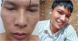 Lộc phụ hồ từ chối phẫu thuật thẩm mỹ vì điều này