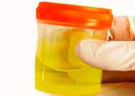 Leucocitele, globulele albe din sange: Leucocitele In UrinÄ In Timpul Sarcinii Cauzele ImbunÄtÄÈirii Èi Tratamentului Competent Despre SÄnÄtate Pe Ilive