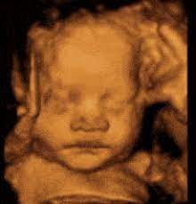 Feb 11, 2020 · how much does a 3d ultrasound cost? 3d 4d Ultrasound Fine Art Newborns