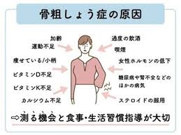 骨粗しょう症1,590万人時代...女性と子どもの骨を守りたい！ - CAMPFIRE (キャンプファイヤー)