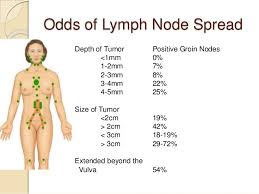 This may be because cancer cells use up much of the body's energy supply. What Are The Symptoms Of Groin Cancer Female Lymph Nodes And Cancer The Groin Area Is The Area Where The Upper Thigh Meets The Lower Abdomen