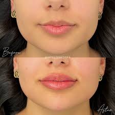 Elite Medspa + Wellness Center