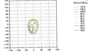 patient specification quality assurance for glioblastoma