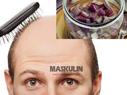 Menurut mitos bahwa mengkonsumsi buah nanas muda dapat cara menggugurkan janin dengan nanas muda. Cara Mudah Hilangkan Masalah Rambut Gugur Botak Guna Bawang Merah Dengan Madu Je Maskulin