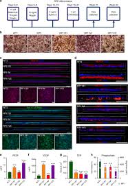 Compare prices online and save today! Disrupted Alternative Splicing For Genes Implicated In Splicing And Ciliogenesis Causes Prpf31 Retinitis Pigmentosa Nature Communications