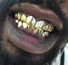 Self impression kit (mold kit) *. Gold Grillz Miami On Twitter 8 8 14k Solid Yellow Gold Grillz Deep Cut Permanent Look Call Text 305 989 6479 Order Online Https T Co Aaj8sqngtr Goldgrillz Solidgold Https T Co H6xdvbwnlq