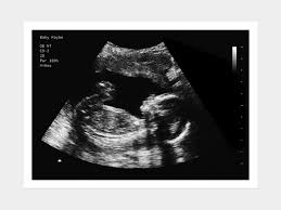 Ultrasound spoof is a fake pregnancy prank mobile app that helps its users to make a fool of family and friends. 12 Weeks Fake Ultrasound W Instant Download