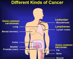 It'll also let him know if you have a fever or infection. How Would You Know If You Have Bone Cancer