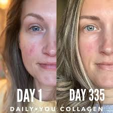 Marine collagen benefits