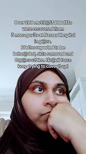 Ireal Largest Skin Bank