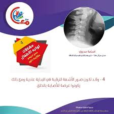 مشكلات تواجه الاطفال ممن لديهم متلازمة داون اعاقة توعية اسامة مدبولي osama madbooly natinal day disability awerenessdayاسامة مدبولي yoro pie chart chart