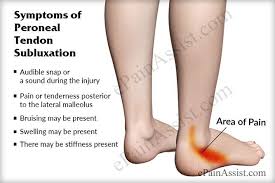 Symptoms Of Peroneal Tendon Subluxation Or Dislocation Peroneal Tendonitis Sprained Ankle Remedies Ankle Strengthening Exercises