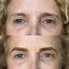 Michael Hanger (@saint.michel.esthetics) • Instagram photos and videos