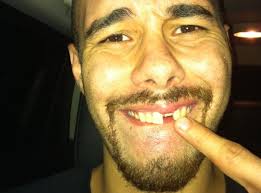 Doug Kramer fighting tooth and nail
