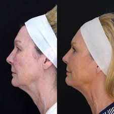 Ada West Dermatology