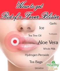 How To Get Rid Of A Fever Blister Healthy Focus Fever Blister Fever Blister Home Remedy Fever Blister Remedy