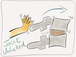 Facet Joint Syndrome Treatment Sundial Clinics