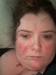 Brentwood woman fears she will die in 'unsuitable' home