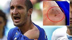 Arsenal fans chant she said no to robin van persie after. No Place In Brazil Luis Suarez Should Be Banned For Six Months Illawarra Mercury Wollongong Nsw