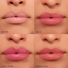An incision is made on the inside of the lower lip and the bump (oral mucocele) is removed. Power Full Plump Lip Balm Buxom Sephora Tinted Lip Balm Hydrating Lip Balm The Balm