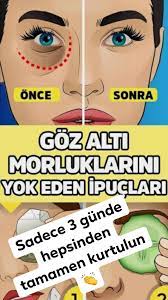 Gozalti Morluklarini 3 Gunde Gecirip Cam Gibi Gozlere Kavusun Health Fitness Beauty Hacks Health
